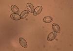 Helvella macropus var. brevis spores