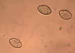 Helvella macropus var. brevis spores