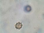 Pisolithus tinctorius spores