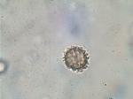 Pisolithus tinctorius spores