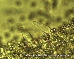 Pluteus admirabilis cystidia